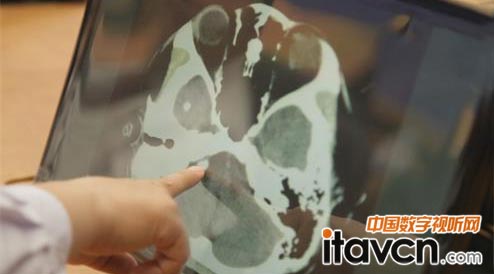 Polycom公司為國家遠程卒中中心基地醫院宣武醫院提供了遠程視頻系統