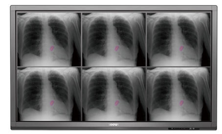 (希沃醫療機型可清晰還原醫學影像)