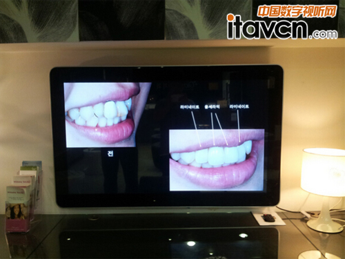 口腔牙科醫(yī)院應(yīng)用液晶廣告機(jī)案例