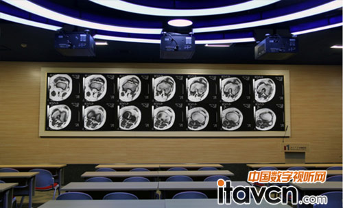 dnp ��Ļ�����[����Ӗ�@��dnpȫ���¶����