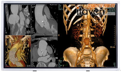 BJB 84寸專業工程液晶顯示器